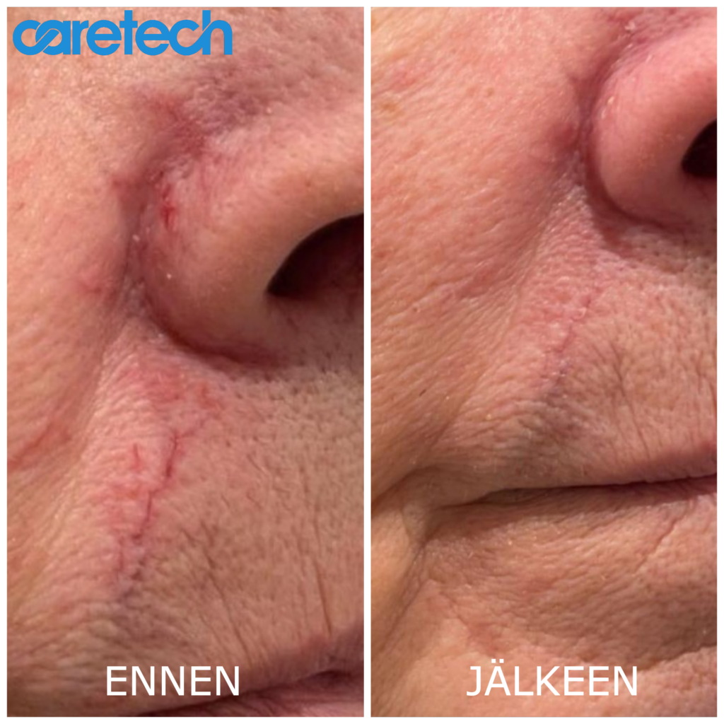 BeautyQ Ennen ja jälkeen Oikea logo